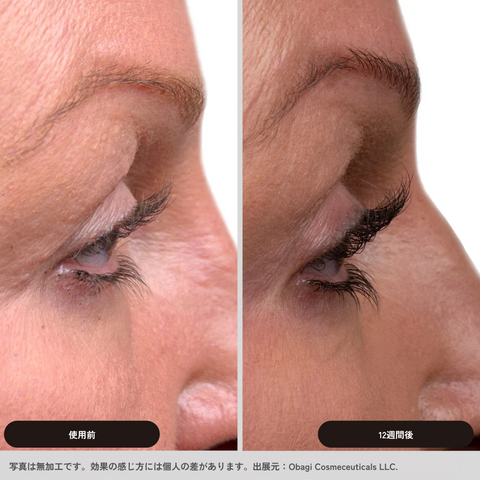 Obagi Nu-Cil – Eyelash Enhancing Serum